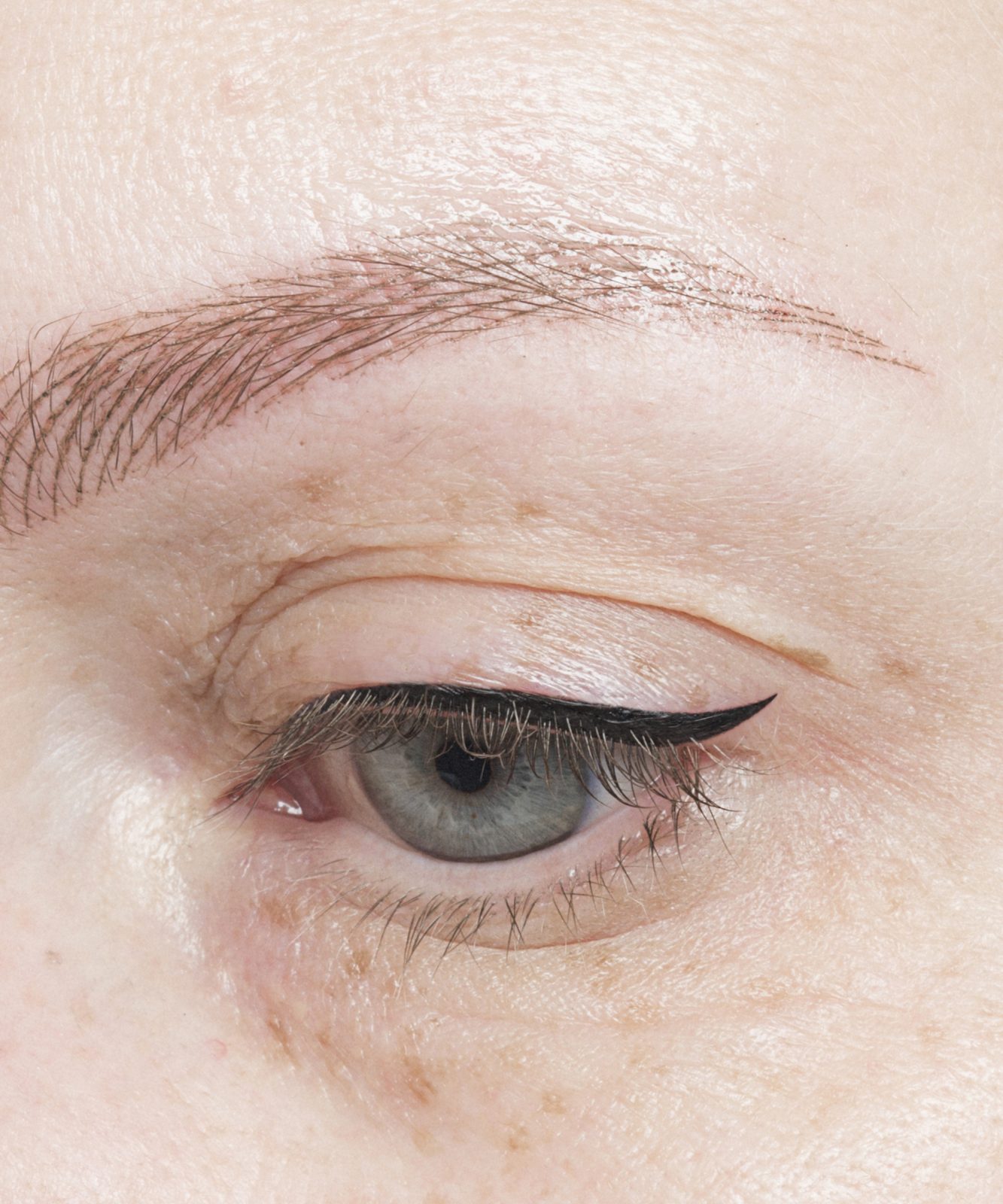 After: Eyes