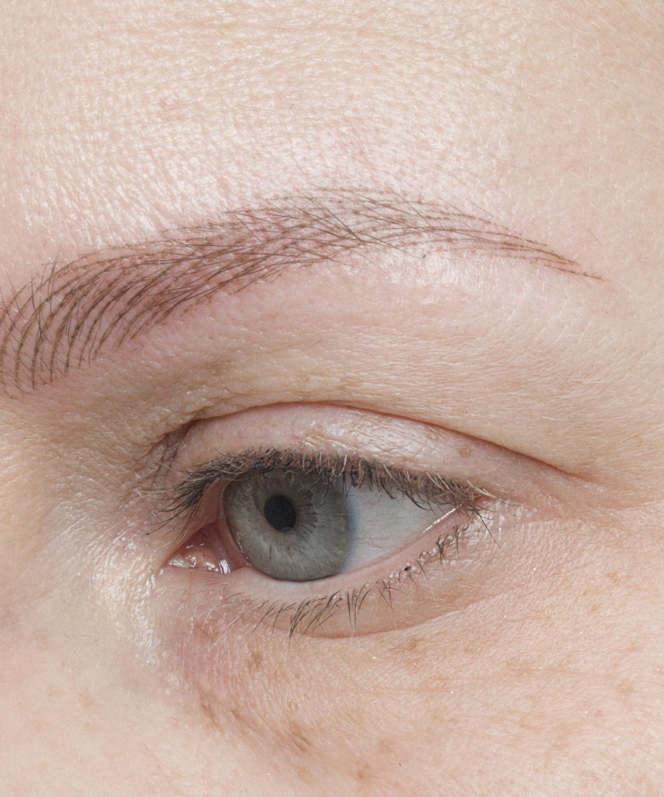 Before: Eyes