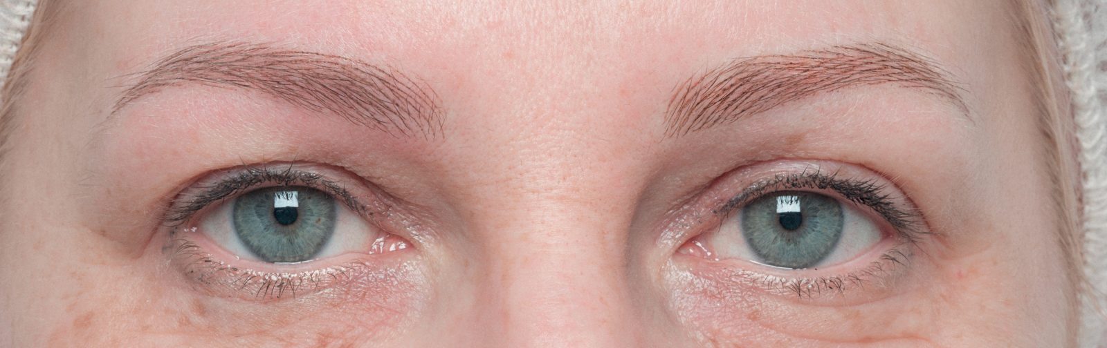 After: Eyebrows