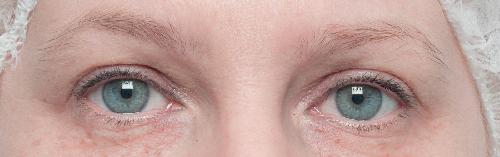 Before: Eyebrows