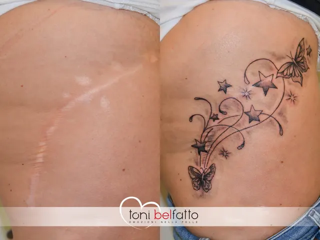 Cicatrice coperta con un tatuaggio artistico, prima e dopo