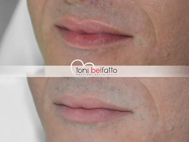 Maquillage permanent des lèvres, avant et après