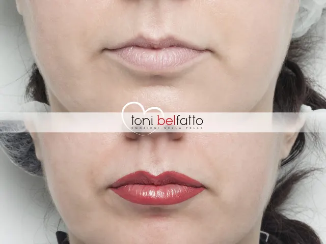 Maquillage permanent des lèvres, avant et après