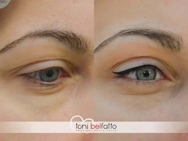 Permanent eyeliner, before and after