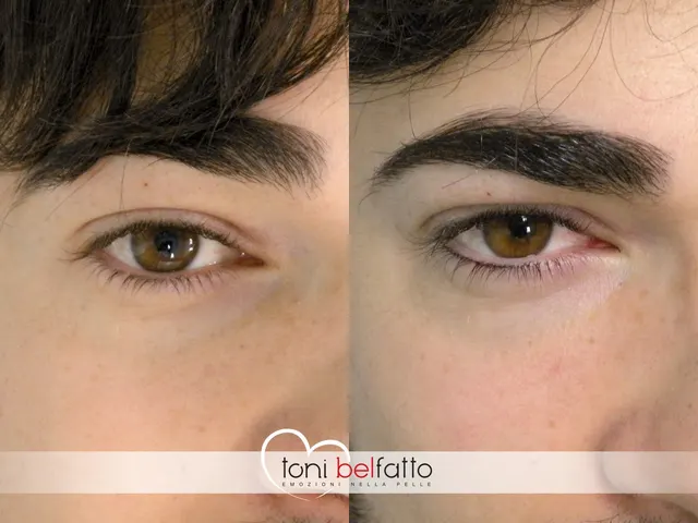 Permanent eyeliner, before and after