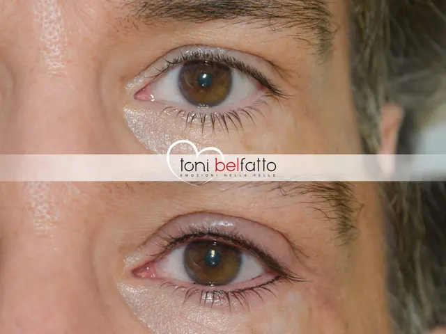 Permanent eyeliner, before and after